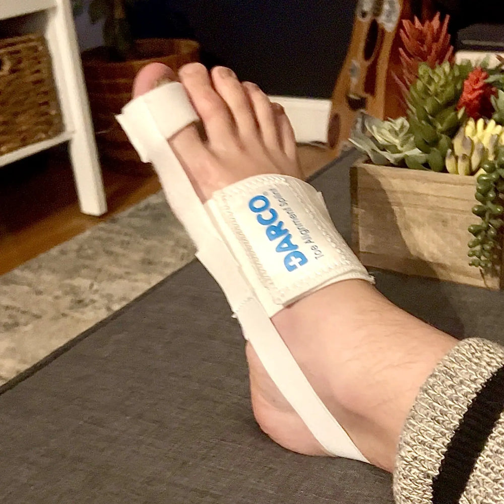 Toe Alignment Splints are commonly used to gently correct toe alignment and mitigate bunions