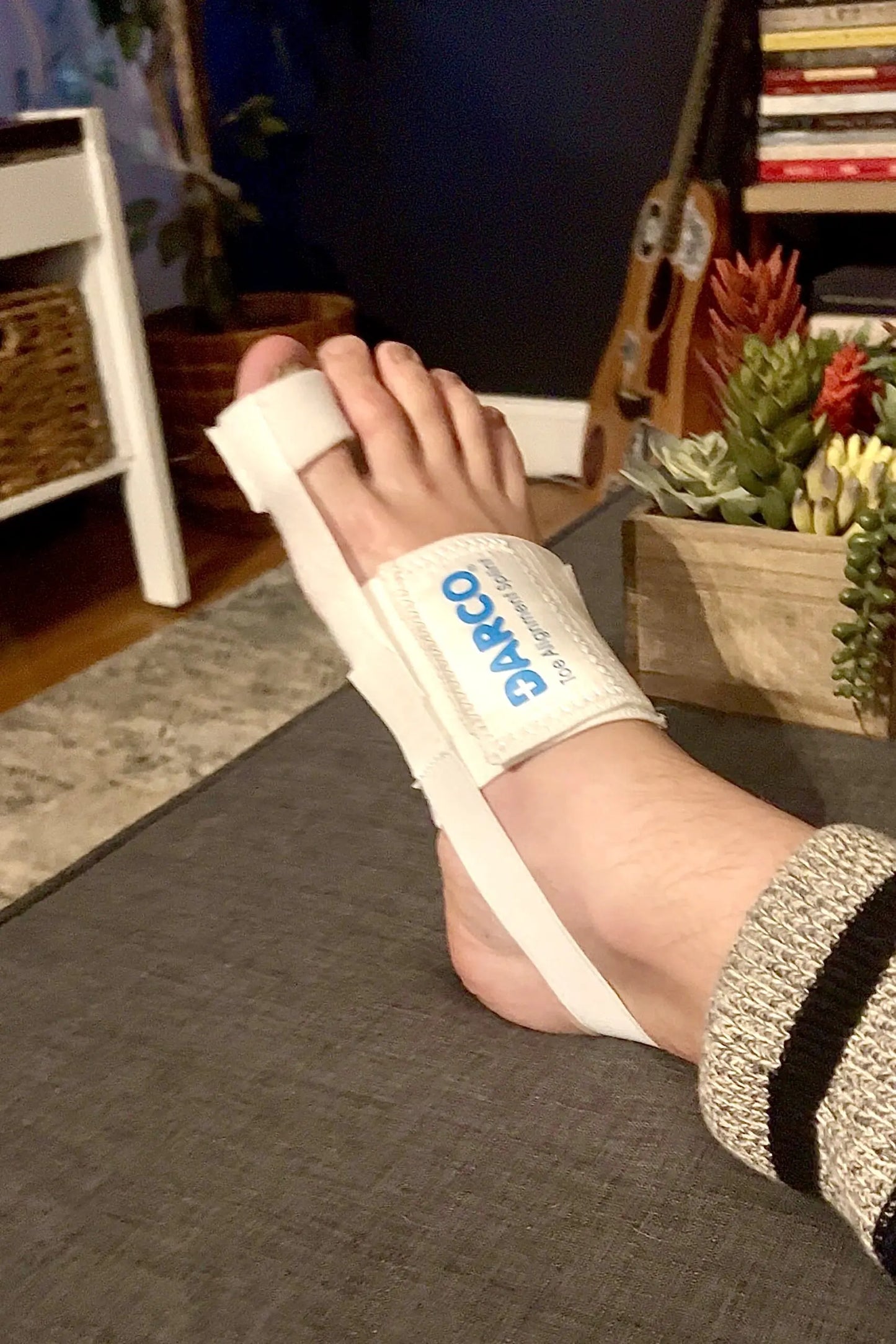 Toe Alignment Splints are commonly used to gently correct toe alignment and mitigate bunions