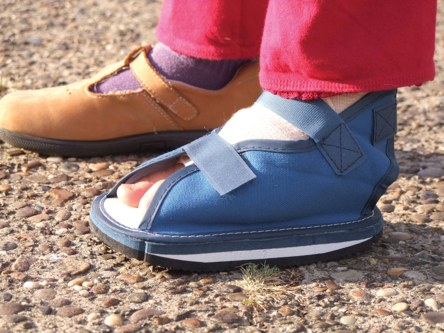 Rocker sole helps relieve pressure when walking
